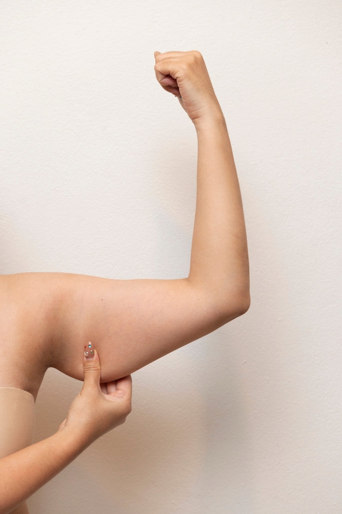 Arm Lift Surgery Malaysia