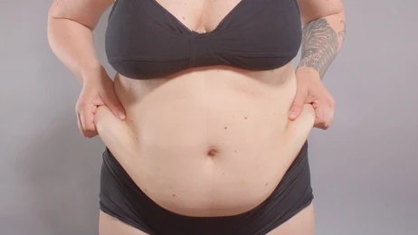 Fat Transfer