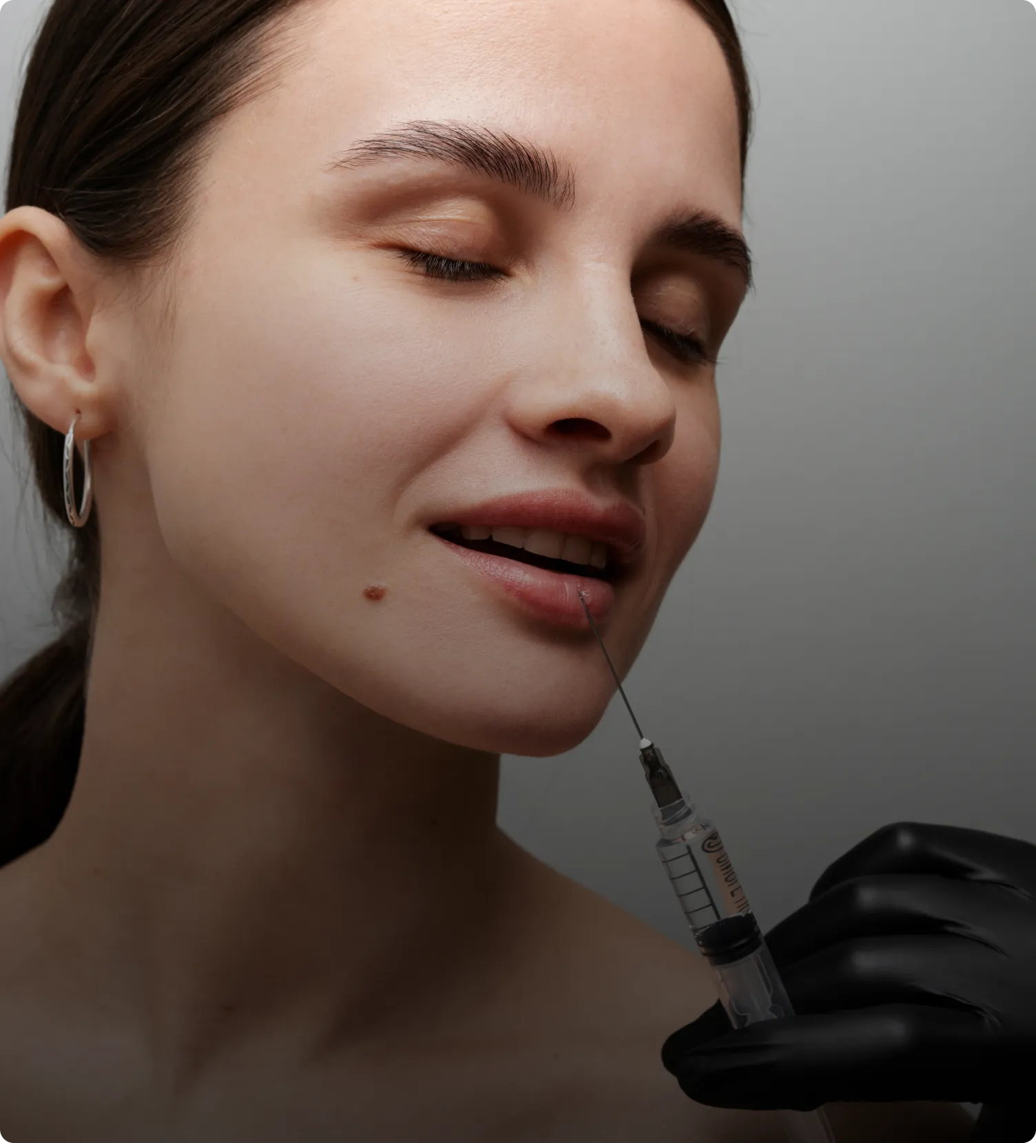 Lip Filler