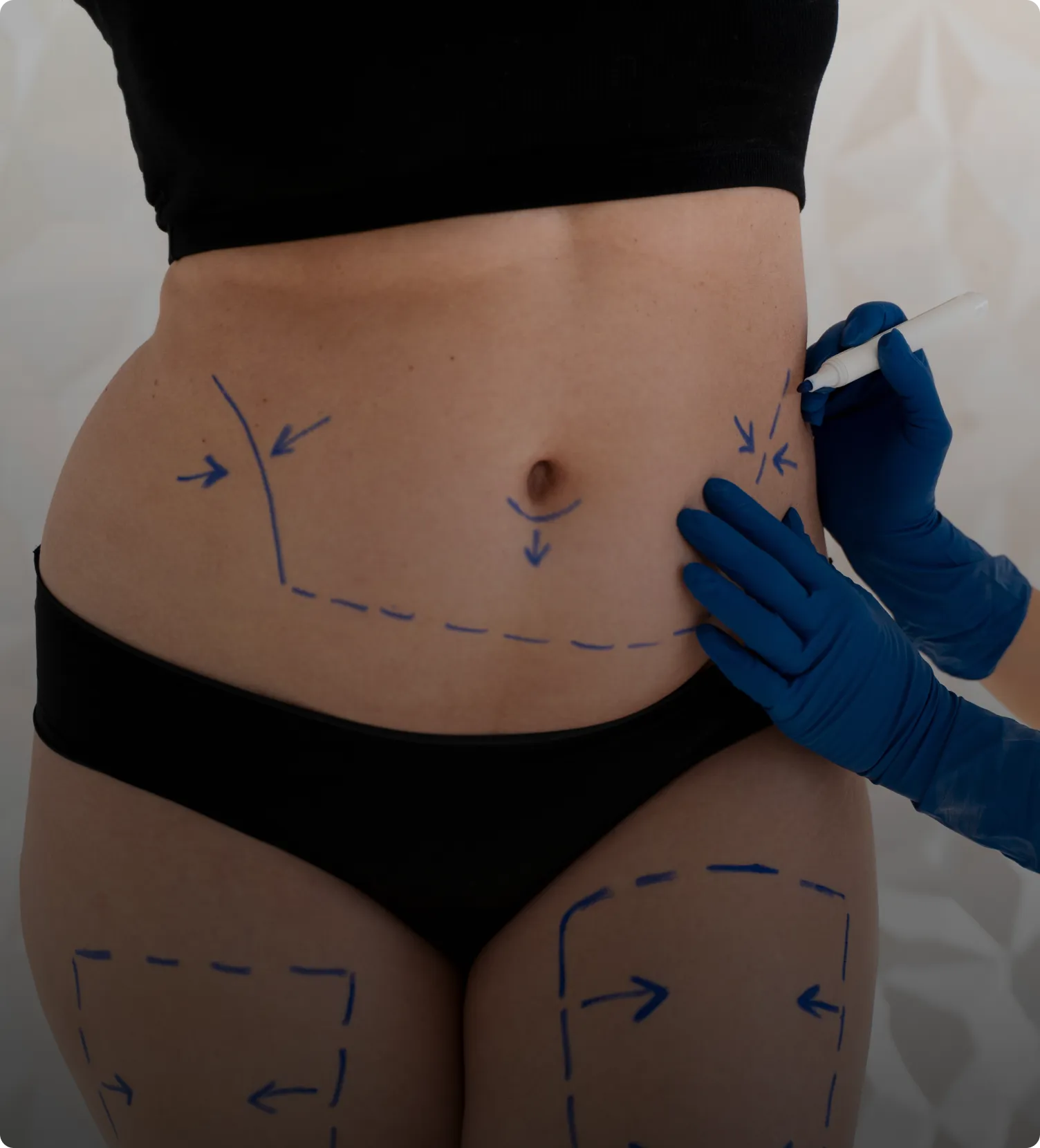 Body Contouring Malaysia