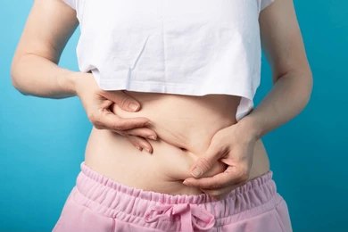 Stomach Liposuction